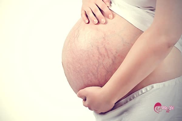 Mang Thai Mấy Tháng Thì Bụng To? Kích thước bụng bầu phụ thuộc vào cơ địa và số lần mang thai