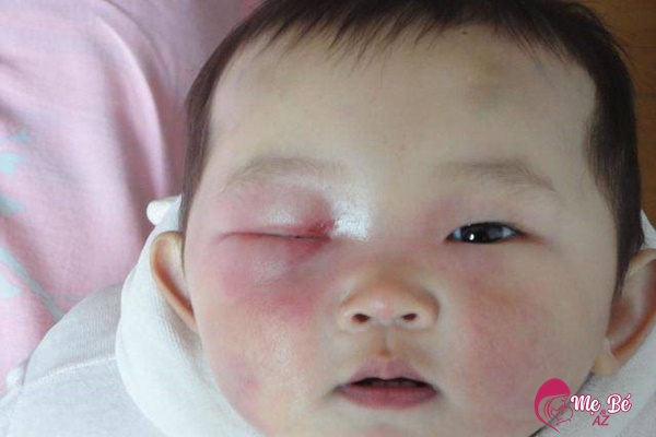 Nguy cơ tiềm ẩn khi cắt lông mi cho trẻ sơ sinh