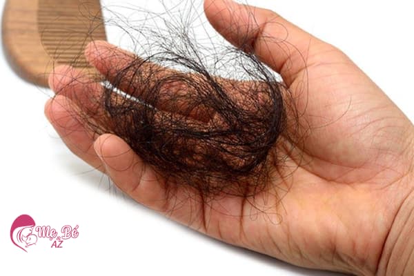 Sau Sinh Bao Lâu Thì Rụng Tóc? Giải Đáp Từ Chuyên Gia