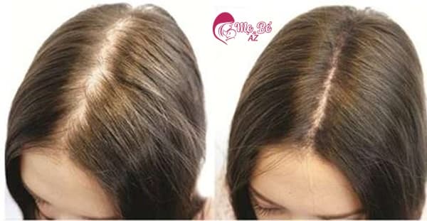 Sau Sinh Bao Lâu Thì Rụng Tóc? Giải Đáp Từ Chuyên Gia