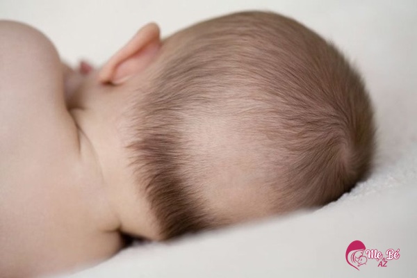 Trẻ Sơ Sinh Mọc Ít Tóc: Nguyên Nhân Và Cách Khắc Phục Trẻ sơ sinh mọc ít tóc có thể do thiếu canxi