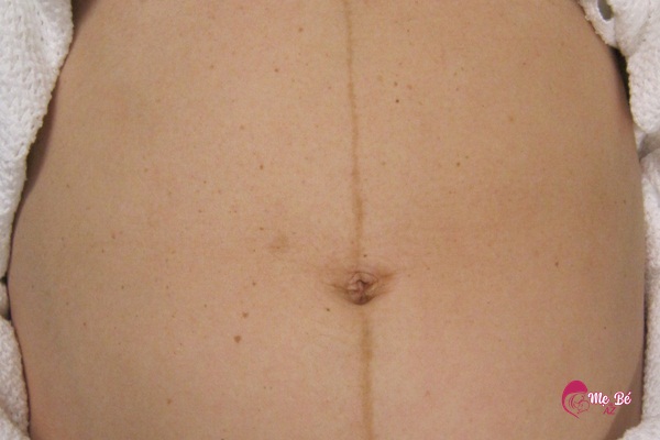 Phụ nữ mang thai với vùng bụng lớn