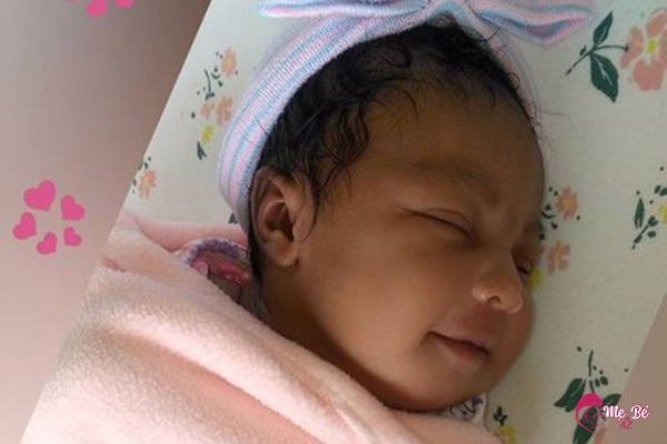 Trẻ sơ sinh da đen