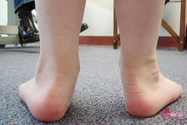 Bàn chân trẻ