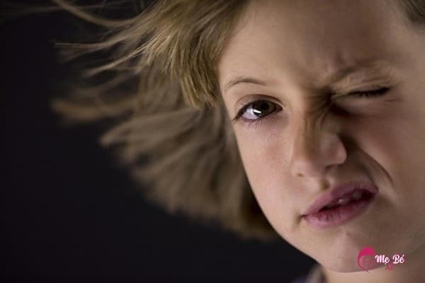 Bé bị nháy mắt