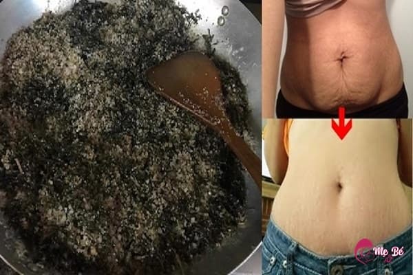 Mô tả hình ảnh: Chườm muối thảo dược là cách giảm mỡ bụng sau sinh hiệu quả.
