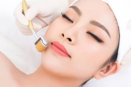 Trị Rạn Da Sau Sinh: Phương Pháp Nào Hiệu Quả?