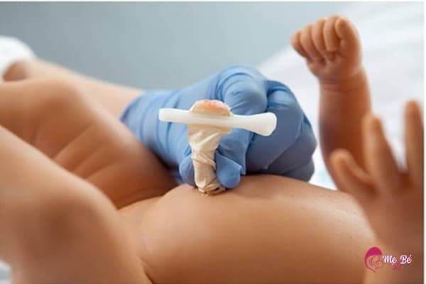 Cuống rốn của trẻ sơ sinh