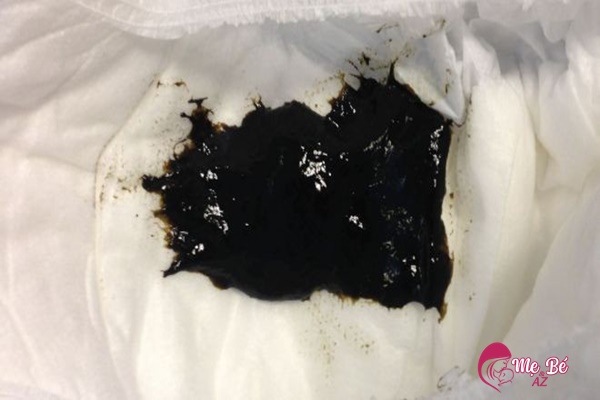 Phân su của trẻ sơ sinh