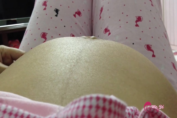 Hình ảnh minh họa thai máy yếu