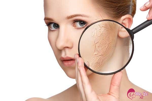 Bí Quyết Làm Đẹp Sau Sinh Với Sữa Tươi: Đơn Giản Và Hiệu Quả Sữa tươi giúp cải thiện da khô