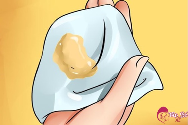 Khí Hư Màu Vàng Khi Mang Thai: Bình Thường Hay Bất Thường? Khí hư màu vàng khi mang thai có thể là hiện tượng sinh lý bình thường