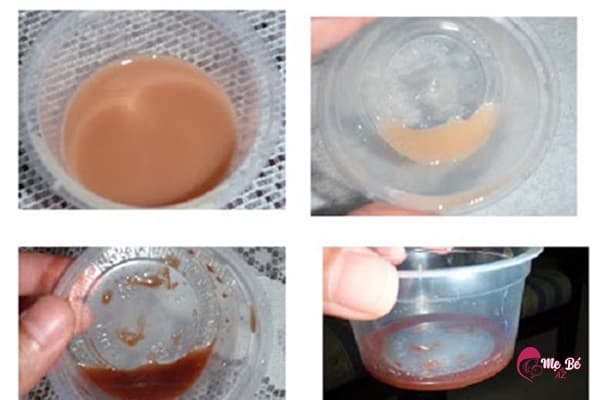 Sữa mẹ màu đen có thể do mẹ sử dụng thuốc kháng sinh