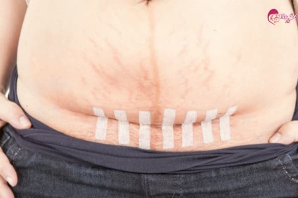 Quan Hệ Tình Dục Sớm Sau Sinh: Những Điều Cần Biết