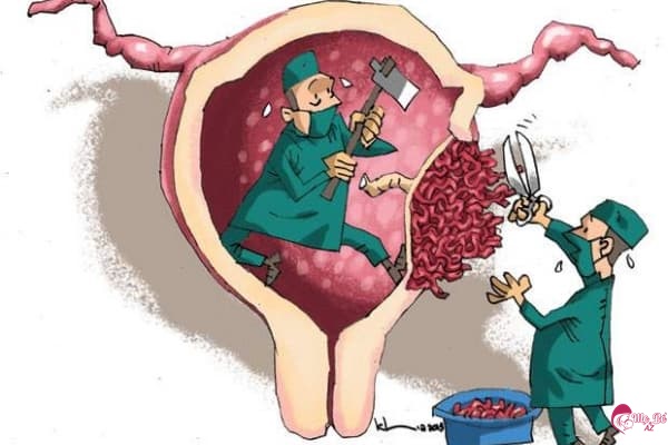 Nhau cài răng lược sau sinh mổ