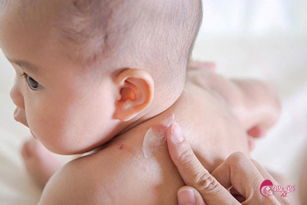 Kem chữa hăm cho bé