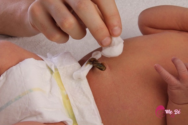 Luôn để rốn trẻ thông thoáng, sạch sẽ