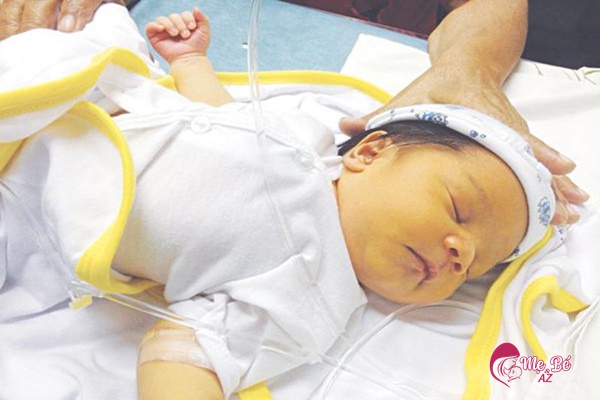 Cho bé bú nhiều để tránh mất nước khi chiếu đèn