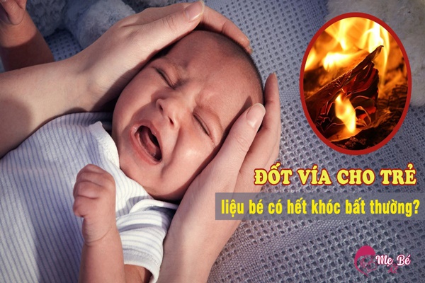 Cân nhắc kỹ trước khi áp dụng phương pháp đốt vía cho trẻ sơ sinh