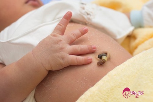 Giữ rốn trẻ sơ sinh khô thoáng và sạch sẽ