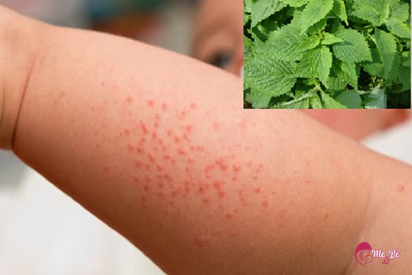 Tắm lá kinh giới trị rôm sảy cho bé