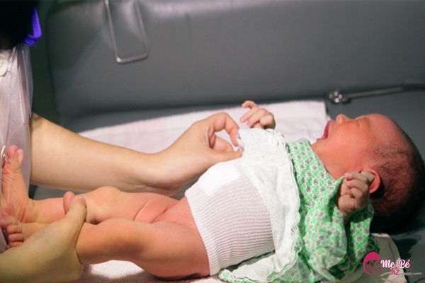 Hình ảnh minh họa chảy máu rốn ở trẻ sơ sinh