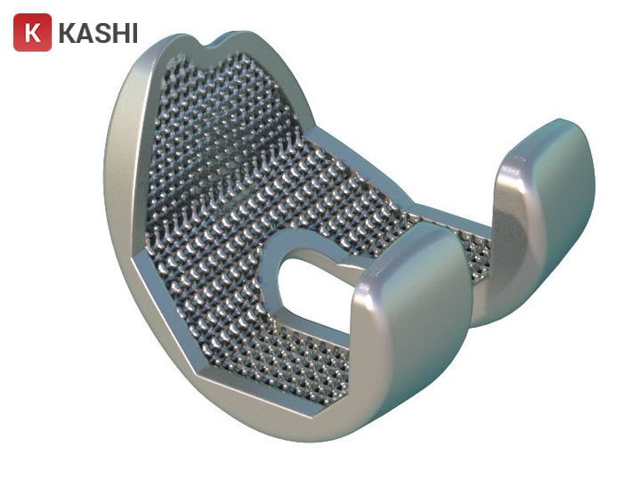 Cấu trúc dạng lưới trong Siemens NX